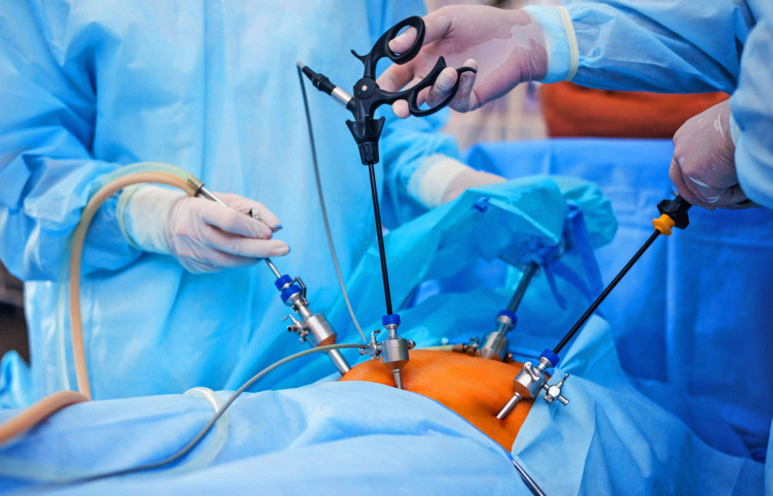 Laparoscopy Brochure